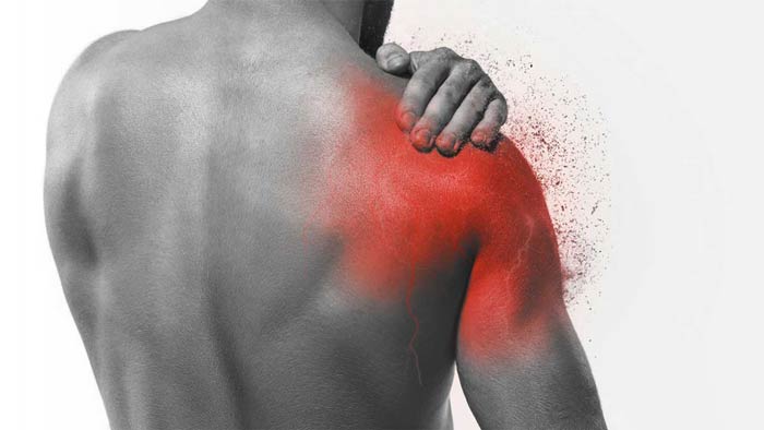 همه چیز درباره کتف درد عصبی و درمان آن با طب فیزیکی