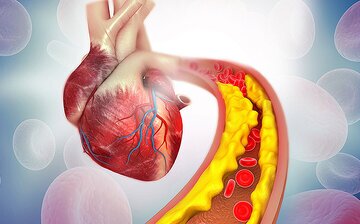 کاهش کلسترول خون با مصرف یک داروی گیاهی