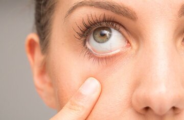 ردگیری کوچک شدن مغز از طریق چشمها