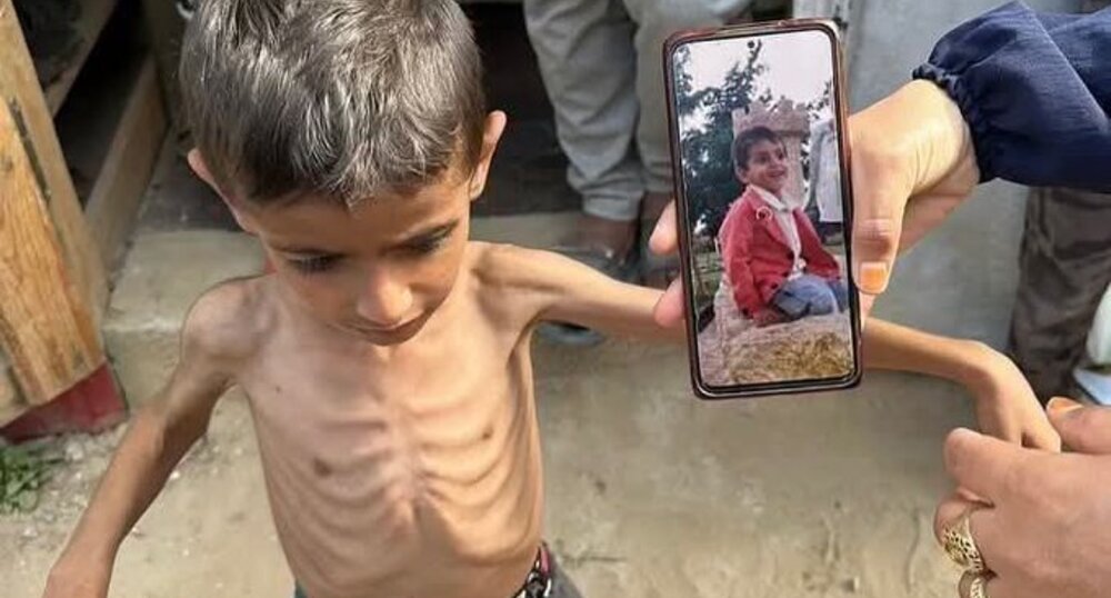 جهانی شرمسار گرسنگان غزه! - ایسنا